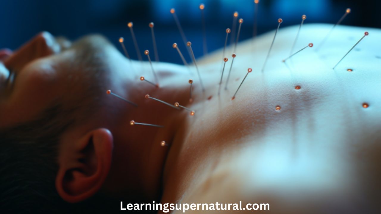 Acupuncture For Healing